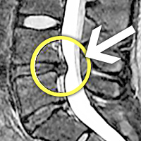 /Upload//16/Thumb_Thumb_mri_20180524_s.jpg
