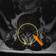 MRIġ���� �̹���