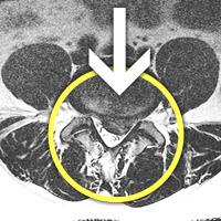 MRIġ���� �̹���