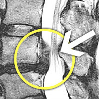 MRIġ���� �̹���