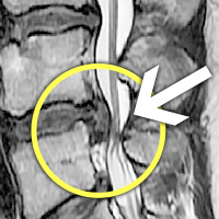 MRIġ���� �̹���