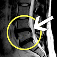 MRIġ���� �̹���