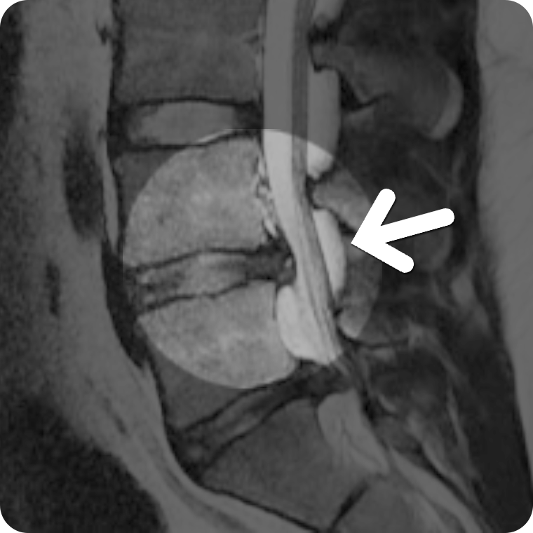 MRI  3
