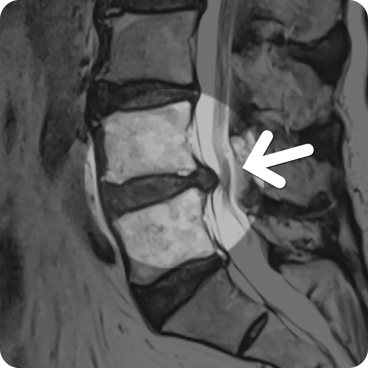 MRI  1