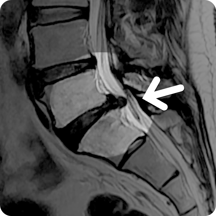 MRI  1