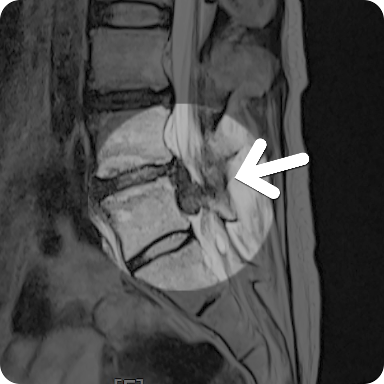 MRI  1