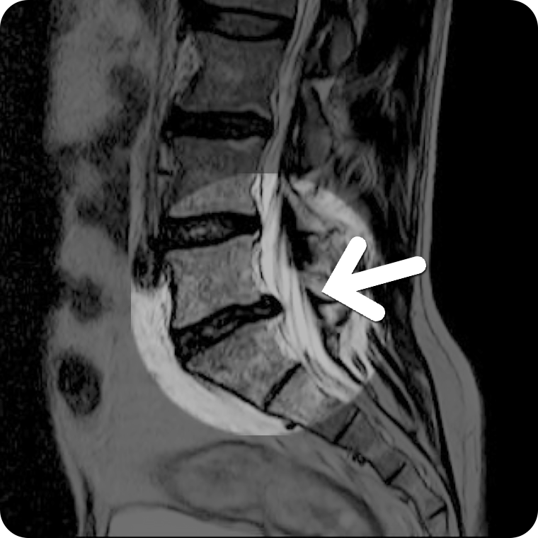 MRI ���� ���5