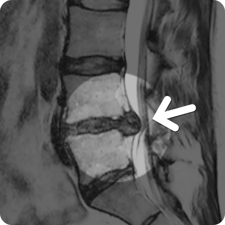 MRI ���� ���4